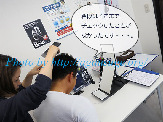 AGAスキンクリニック頭皮チェックミラー偏