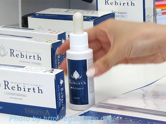 AGAの説明薄毛の要因はこれ