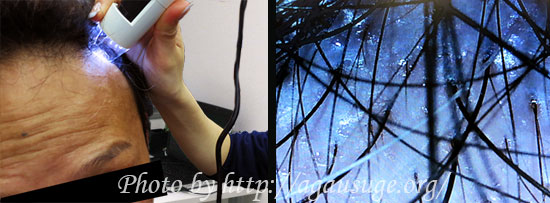 スコープ前頭部チェック