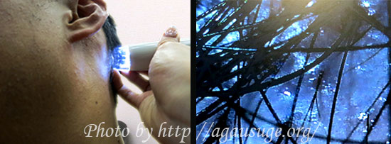 スコープ後頭部チェック