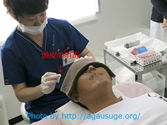 ドクターメソ治療冷却麻酔中