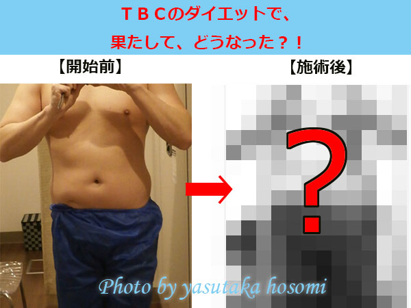 メンズTBC比較前