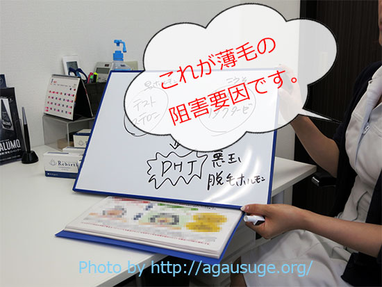 AGAの説明薄毛の要因はこれ